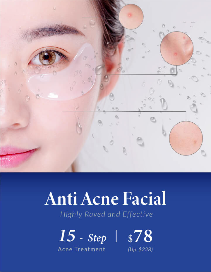 Anti Acne Treatment_Mobile Banner